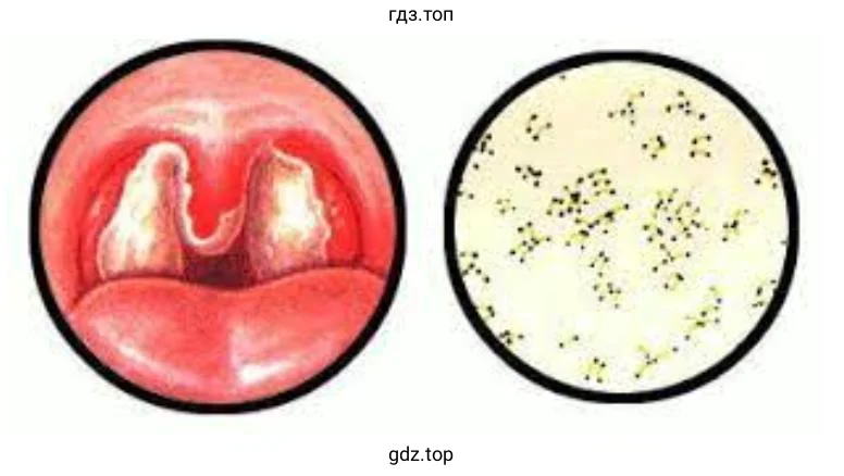 Дифтерийная палочка